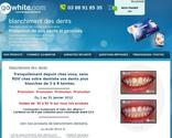 Vente en ligne de produits de blanchiment des dents